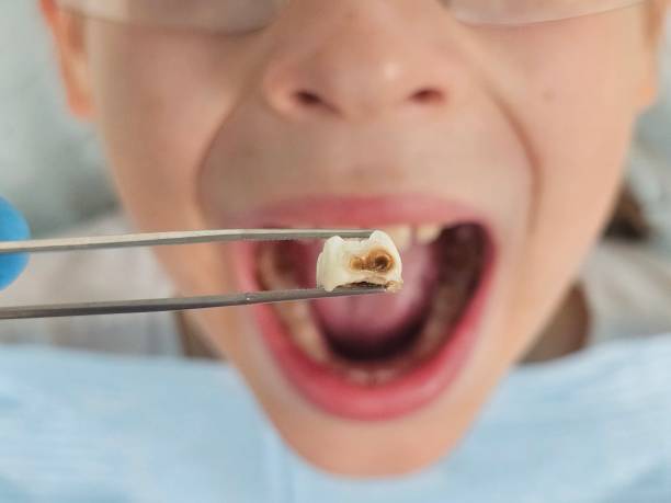 Best Orthodontic Emergency Dentist in Palos Hls, IL