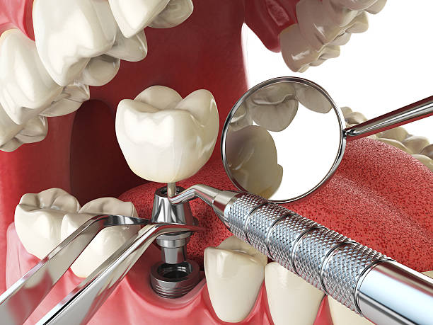Best Emergency Cosmetic Dentistry in Palos Hls, IL